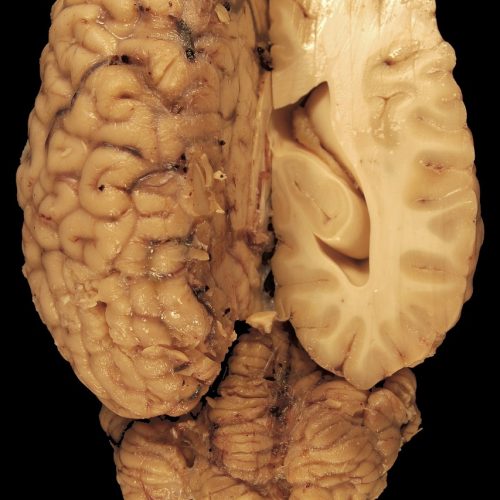 brain, anatomy, eyes-114069.jpg